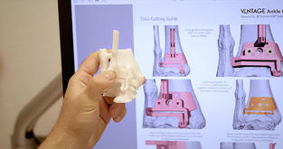 a 3D printed ankle replacement part