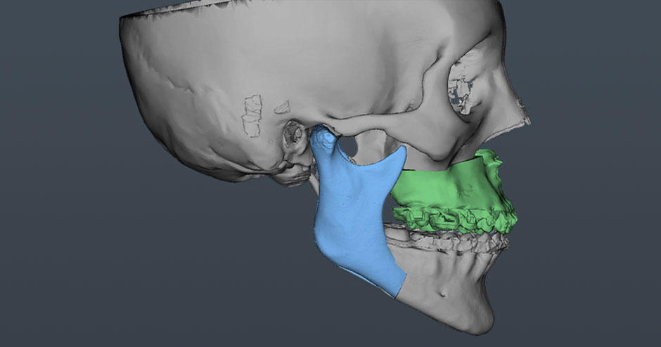 Oral Maxillofacial Surgeon Increases Accuracy, Reduces Operating Time ...