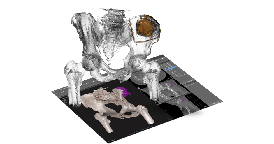 VSP Surgical Planning Solutions | 3D Systems